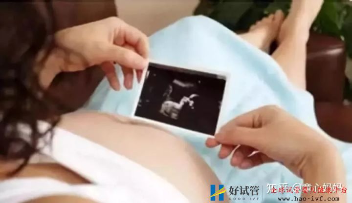 过了30岁做试管婴儿,关注这些比关注成功率更重要!(图10) 过了30岁做试管婴儿,关注这些比关注成功率更重要!(图10)