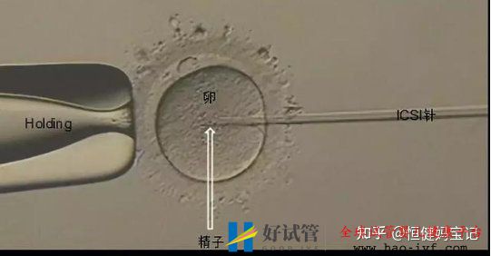 第三代试管婴儿费用是多少,大致的流程有哪些(图3) 第三代试管婴儿费用是多少,大致的流程有哪些(图3)