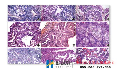 试管婴儿需要什么条件才可以做——系列文2(图1) 试管婴儿需要什么条件才可以做——系列文2(图1)