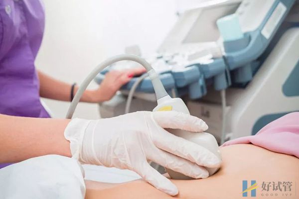 多囊卵巢有三个黄金诊断标准,B超、激素同时看结果才准!(图2) B超提示单侧卵巢中卵泡数较多