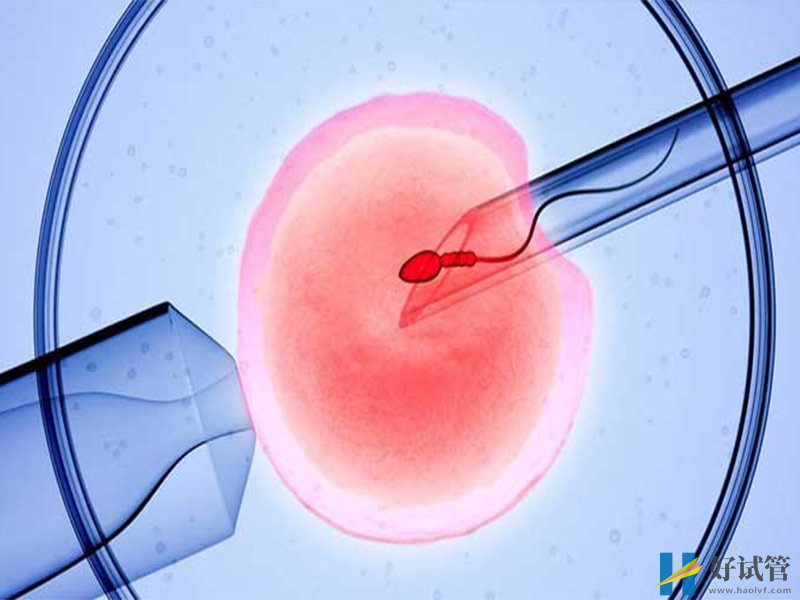 试管婴儿ICSI技术是什么,盘点二代试管婴儿成功率(图1) 第二代试管婴儿技术好于第一代