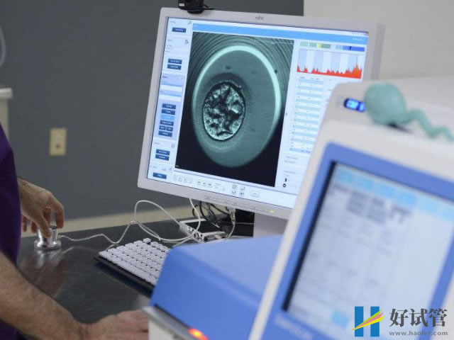 南阳正规供卵机构汇总,最新借卵不排队医院分享(图2) 南阳没有正规卵子库