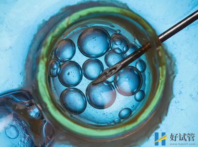 澳门三代试管医院汇总,具体助孕成功率及花费附上(图1) 澳门有能做三代试管的医院