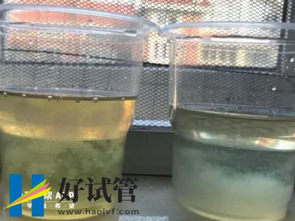 75%酒精测男女有分层图,出现沉淀物那就是女孩(图1) 75%酒精测男生是什么样子