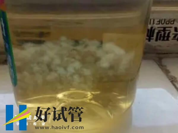 75%酒精测男女有分层图,出现沉淀物那就是女孩(图2) 75%酒精测出女宝宝的状态