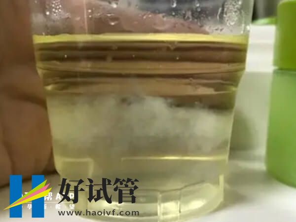 75%酒精测男女有分层图,出现沉淀物那就是女孩(图3) 酒精测男女可不可信