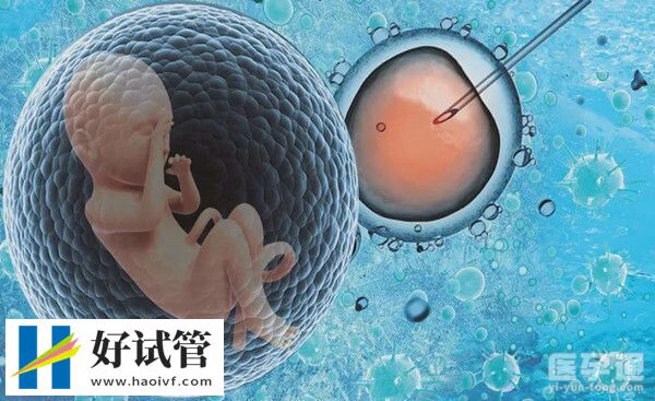 1701917116870341.jpg 1-211103214225M7.jpg