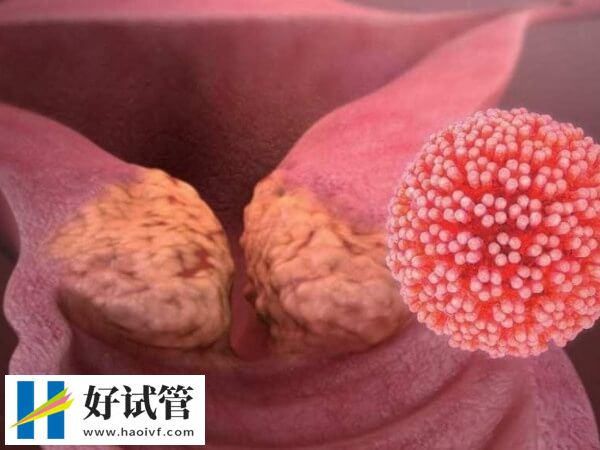 宫颈癌的早期症状是什么(图1) 严重失眠是宫颈癌的早期症状