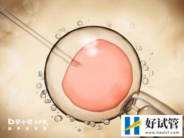 沈阳盛京医院做供精试管多少钱(图1) 盛京医院供精试管收费在3-8万元不等