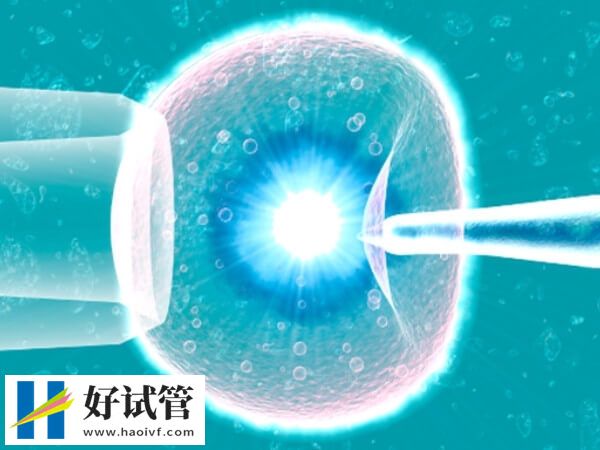 承德做试管婴儿哪个医生好(图1) 承德地区做试管婴儿选杨波医生好