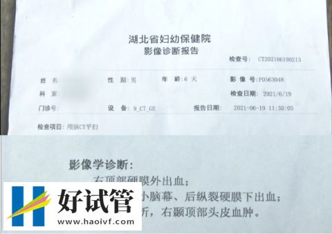 短效长方案的流程(图2) 869f29ba45520c289ffc77c9987a1e9b_texAbbrDDZ1734494540533.png