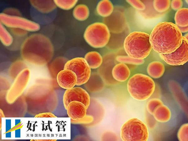 女性做血沉检查后实施试管有无影响(图2) 血沉值可以初步判断炎症反应的程度