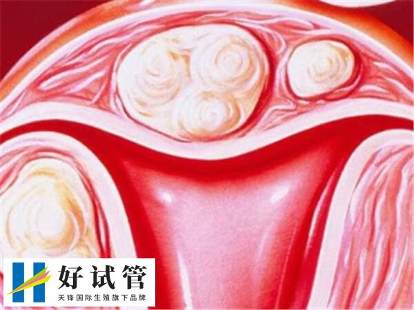 适合移植胚胎的内膜是什么样的(图1) 子宫内膜的厚度不是一个固定值