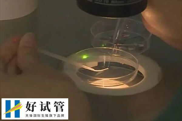 促排后空卵泡是什么原因(图1) 试管促排是一种常见的辅助生殖技术