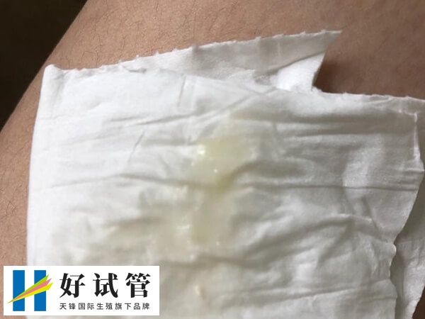 胚胎着床成功排出白带是怎样的(图1) 胚胎着床成功后会出现激素水平上升