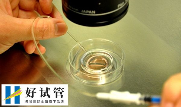 胚胎培养为什么收两次费用(图1) 胚胎培养收费并不固定
