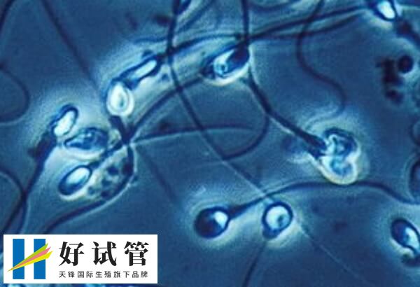 精子抗体也会导致男性不孕不育