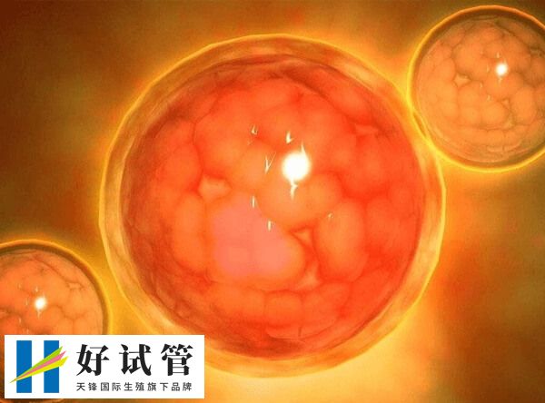 骨髓瘤病例中最常见的发病年龄是65岁左右